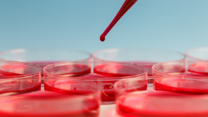 Anemia jedną z chorób krwi Anemia jedną z chorób krwi